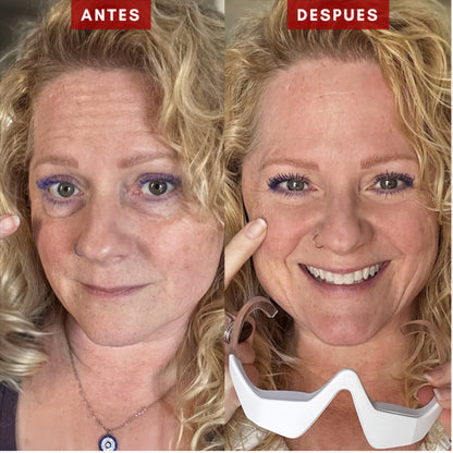 EyeLiftPro™ – Luz Roja + Microcorriente